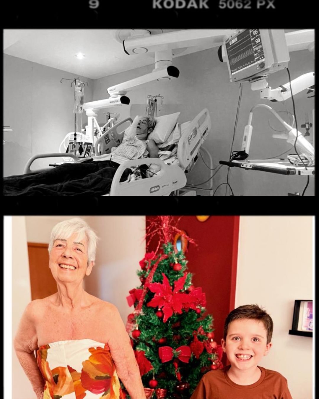 Antes e depois do acompanhamento fisioterapêutico